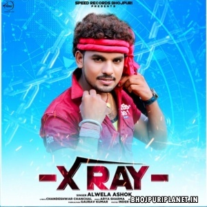 X Ray (Alwela Ashok)